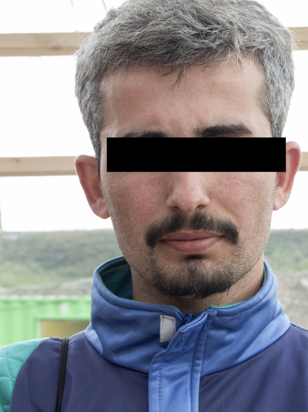 Image of a refugee with his eyes covered. Evidence of them in France hurts their asylum claim.